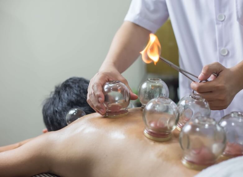 Cupping Therapy